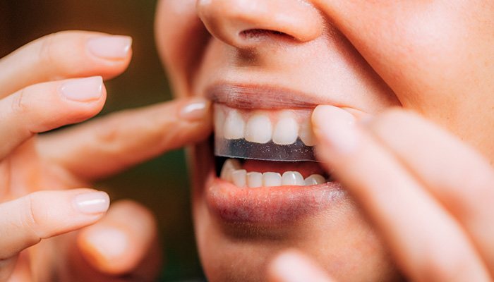 Woman using a teeth whitening strip